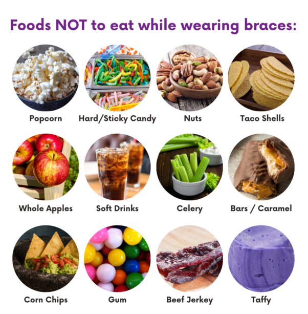 What Foods Can You Eat With New Braces 